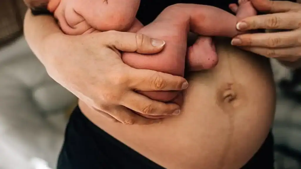 Why Is My Stomach Still Big After Pregnancy Shoreham by Sea?